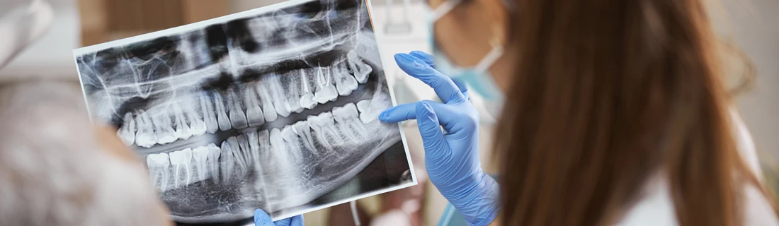 Dentist Shows Patient X-Ray